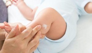 Bỏ túi 6 loại kem bôi muỗi đốt cho bé hiệu quả và an toàn